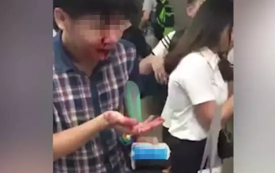 ▲事发现场,有人被撞倒面部流血 图据网络
