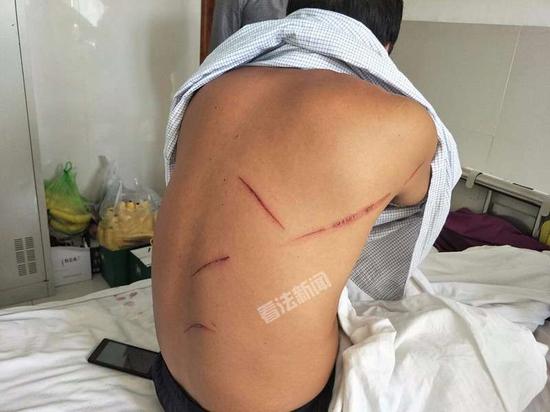 法制晚报·看法新闻 摄影记者董振杰