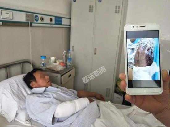 法制晚报·看法新闻 摄影记者董振杰