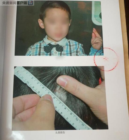 天天中彩票中了一等奖怎么领-天天中彩票中了