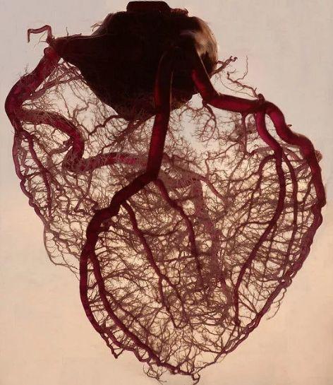 正常人的血管图