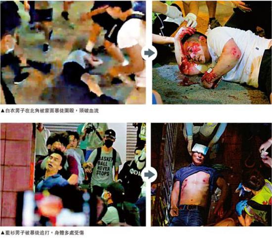 香港暴乱升级，大量爱国爱港市民被攻击