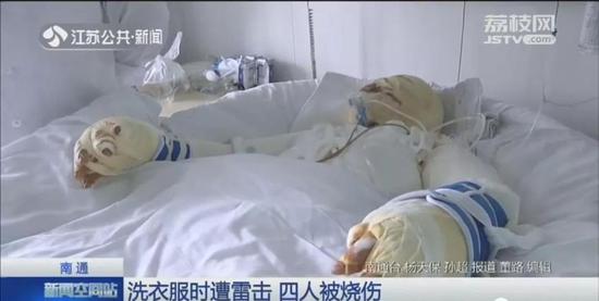 雷雨天4人在院里洗衣服 闪电劈下造成大面积烧伤