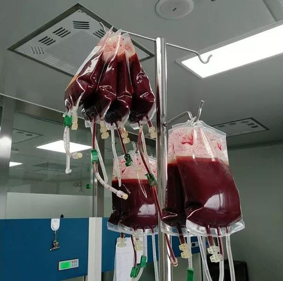 为了救患白血病儿子 男子一口气抽了1866毫升骨髓