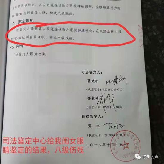 女儿的左眼鉴定结果:八级伤残