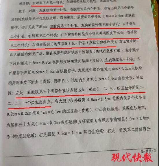 △《司法鉴定意见书》显示,孩子身上有多处针孔