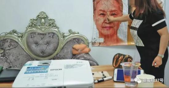 记者卧底“植发3天速成班”:练2小时就给患者手术