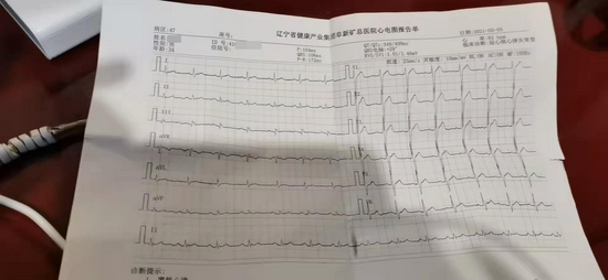 谢鹏今年5月的病例，显示他存在心率失常。