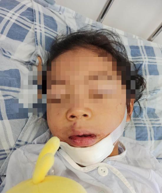 4岁女童被锁幼儿园二楼后坠楼重伤,教育局:园方有重大责任
