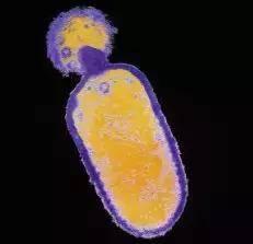 怀孕已5个月孕妇吃冰箱里水果感染 致胎儿死亡