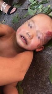 3岁幼儿从17楼坠下还奇迹活着:树枝帮了他