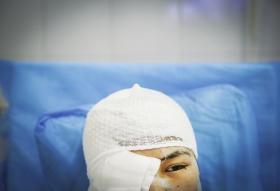 4月12日，湖南省人民医院马王堆院区，被砍伤的黄丽丽（化名）刚从重症监护室转到普通病房。图/记者陈正