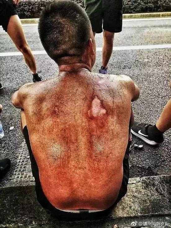  ï¼ˆå›¾ç‰‡æ¥æºï¼š@ç¦å·žæ¶ˆé˜²æ”¯é˜Ÿï¼‰