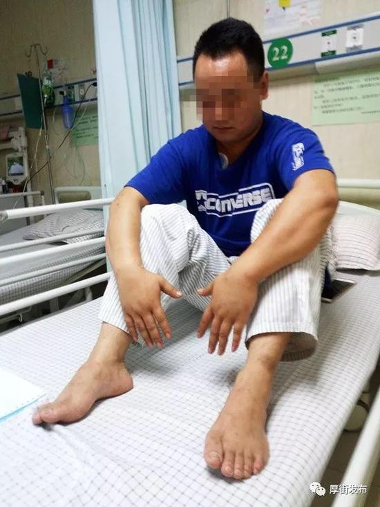 男子被一群蚂蚁咬后失去知觉 还去了趟 鬼门关