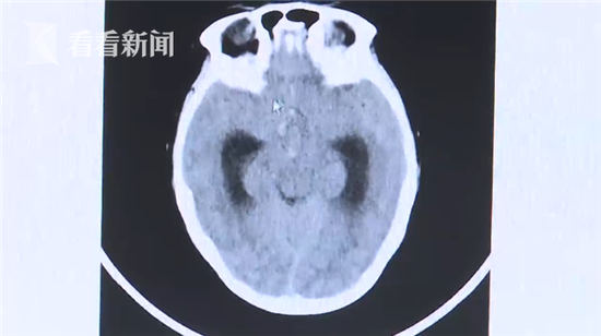 ca888大发亚洲城_宝宝开口说话前,要经历这5个阶段,怎么引导有学问