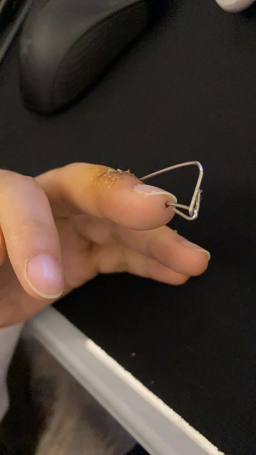 女子下楼扔垃圾，竟扔出个手指断裂！