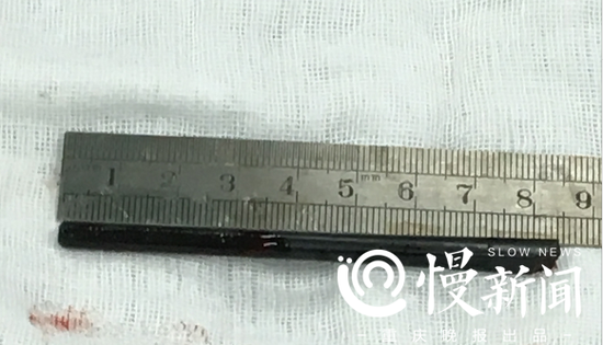 8.5厘米长的筷子被取出