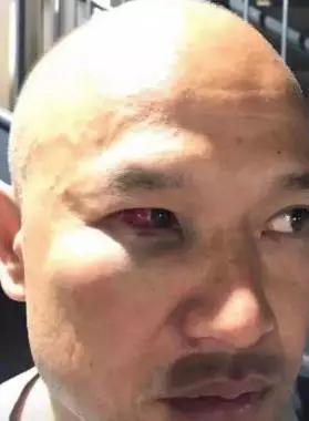 △图片显示,刘sir眼眶已经充血