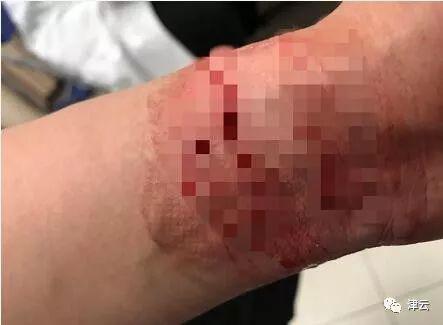 (刘安曾试图割腕自杀)
