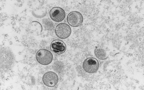  显微镜下的猴痘病毒。（资料图）