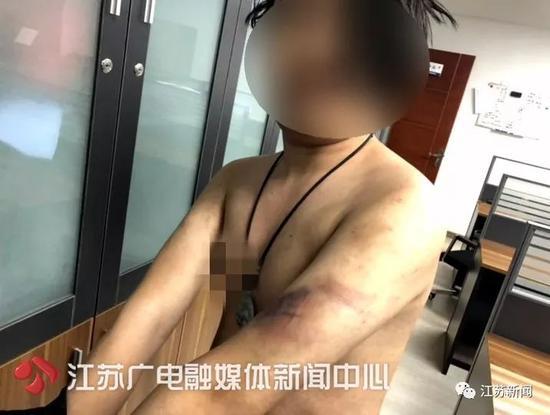 华商报:男子提醒朋友其女友劈腿 反被质疑挑拨遭群殴敲诈