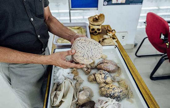 印博物馆展出数百具人脑标本 游客可用手触摸(图)