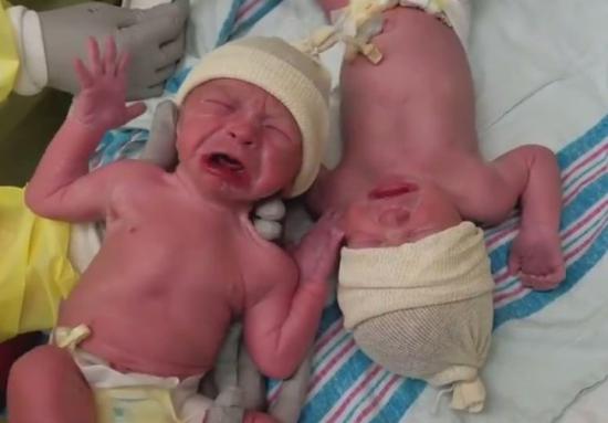 视频：好兄弟！美国双胞胎新生儿，分开一秒便齐声大
