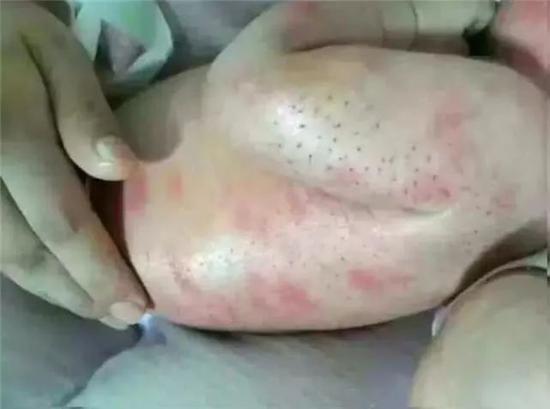 (网络图片)