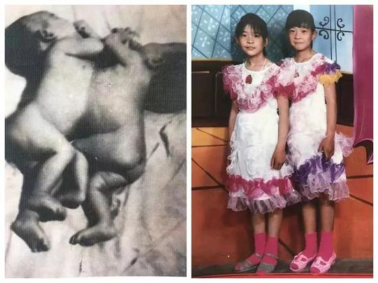 河北这位＂土医生＂走了 为救患者曾对自己割皮取骨