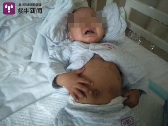 躺在病床上的乐乐