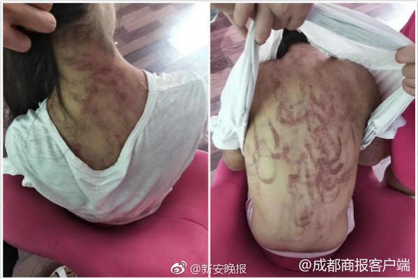 山东医学高等专科学校开展119消防安全主题活动
