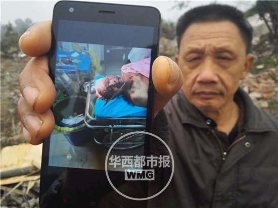 父亲王庆和展示自己被打伤的照片