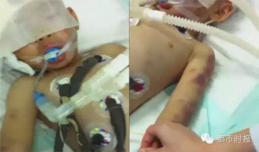 12月19日下午6:20，3岁男孩普谨瑜的生命定格在了这个时刻