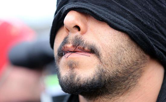 示威者针缝嘴唇抗议法国拆除丛林难民营(图)