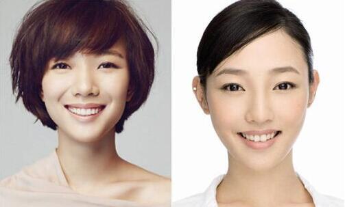 发际线后移1cm,女明星的颜值减了20分|发际线|女明星|刘海_新浪新闻