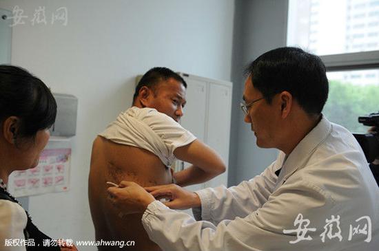 南京总医院的医生为刘永伟检查伤口。