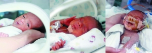 在广医三院出生的三胞胎宝宝，目前满月体重有所增长。