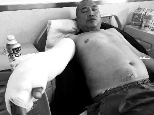 医院中接受治疗的万先生。
