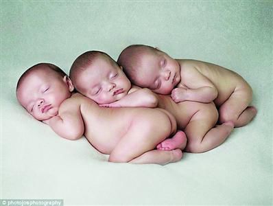 DNA完全一致的三胞胎