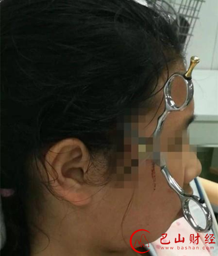 一把剪发用的剪刀从女孩头部右侧插入。