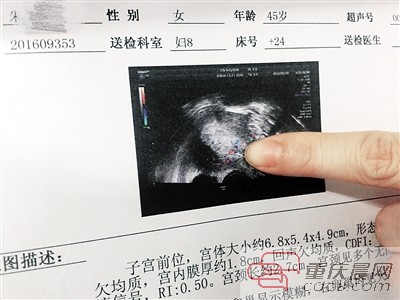 检查报告
