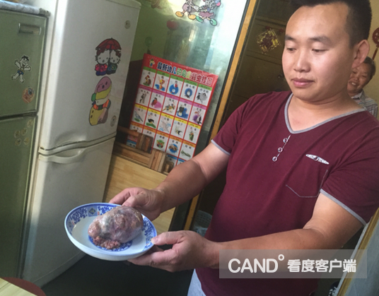 男子展示”鸡宝“