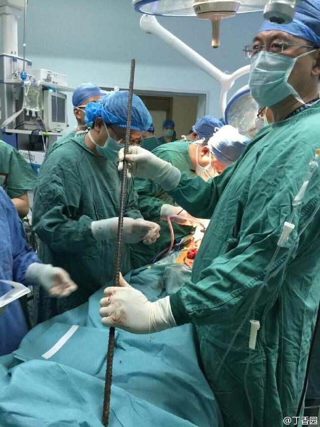 穿身的螺纹钢筋。