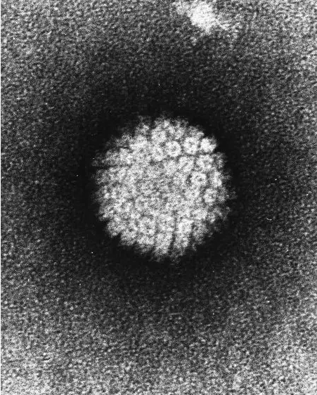 电子显微镜下的Human papillomavirus（HPV）。来源：Wiki