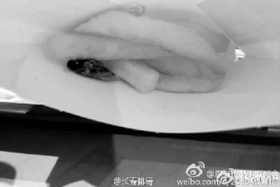 网友爆料的“薯条里吃出虫尸”图片