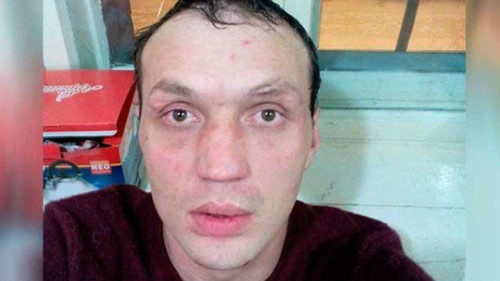 俄罗斯男子怀疑自己被人监控，遂挖开了自己的眼睛寻找监控设备，并将这一过程录成视频发到网上。（网页截图）