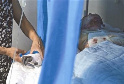 13岁少年泼油烧女教师被免刑太寒心 杨冬玲的妈妈每天都在她身旁照顾她 摄影记者 刘海韵