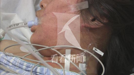 女白领失联30小时遭遇抢劫 活活被勒濒临脑死亡