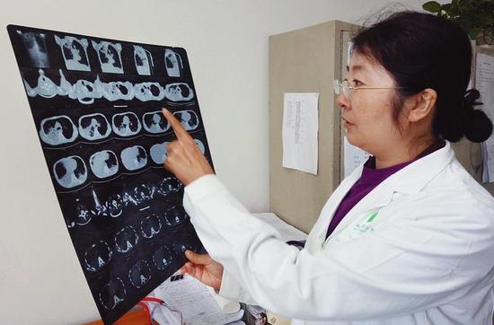 透视的胸片让医生们也惊呆了   三秦都市报记者陈飞波摄