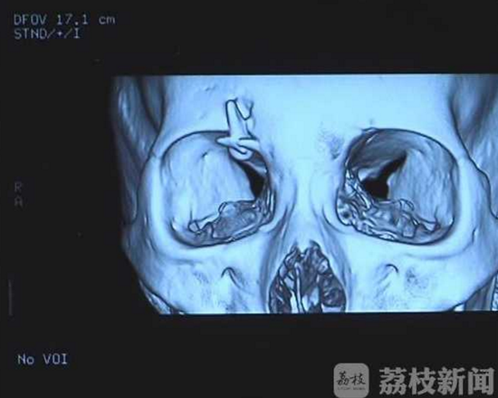 检查拍的片子